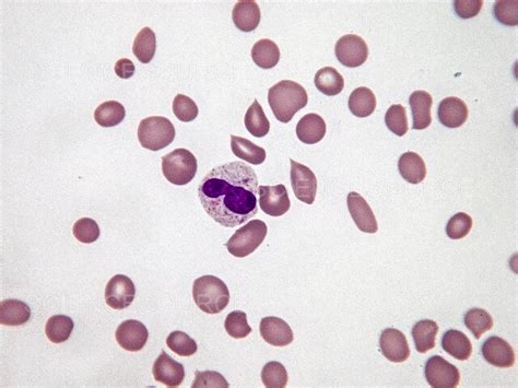 Metamyelocyte, LM | Stock Image - Science Source Images