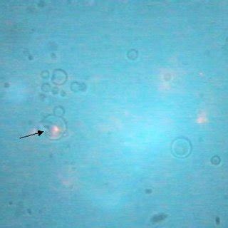 Ablation of an optically trapped PMMA microsphere. (a) A trapped PMMA... | Download Scientific ...