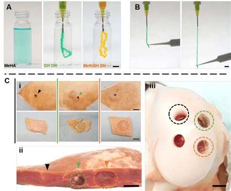 18. Hydrogel injectability. (A-B) Macroscopic images of hydrogels... | Download Scientific Diagram