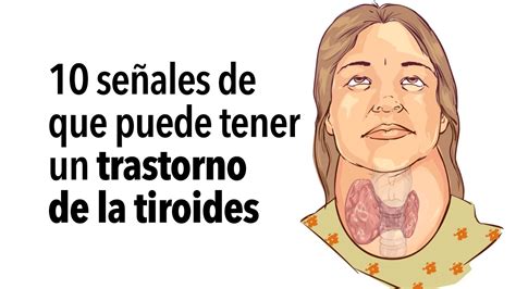 10 señales de que puede tener un trastorno de la tiroides