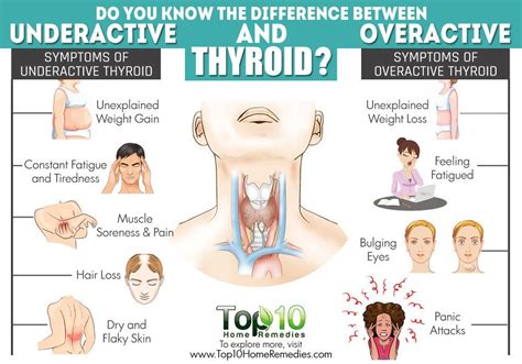 Overactive Thyroid Symptoms -- To view further for this article, visit the image link. # ...