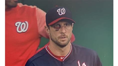 Max Scherzer Pitching With a Black Eye and Broken Nose is Truly a Sight to See