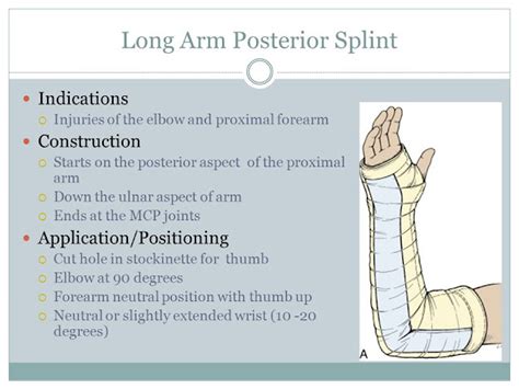 Long Arm Posterior Splint