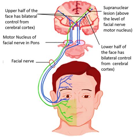 Facial Nerve - Nuclei, functional components, branches and lesions