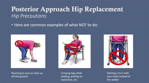 Enloe Total Joint Replacement Program – A Joint Effort Class ...