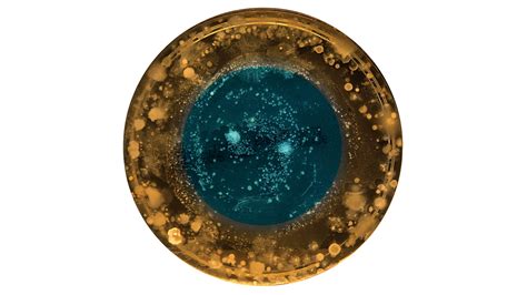 Portraits of Belly Button Bacteria – microBEnet: the microbiology of ...