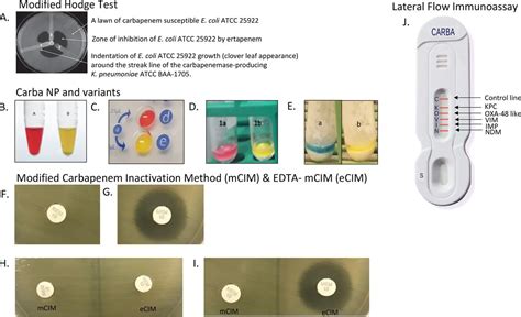 Phenotypic Methods for the Detection of Carbapenemases • Microbe Online