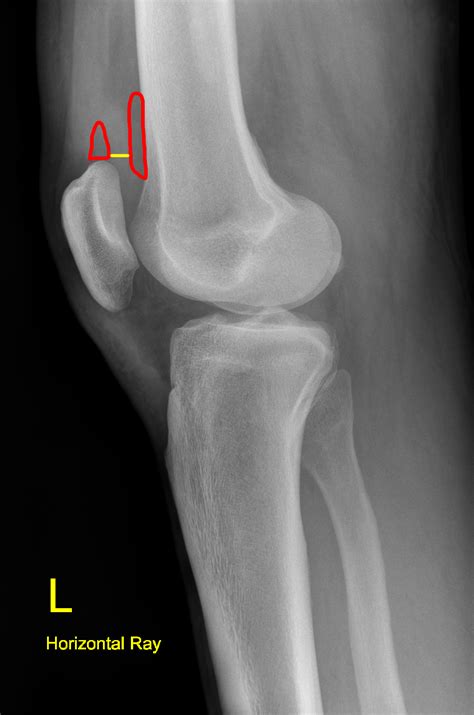 Pin on Musculoskeletal Radiology