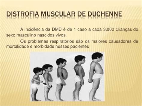 Movimento Duchenne: site traz informação sobre distrofia muscular de ...