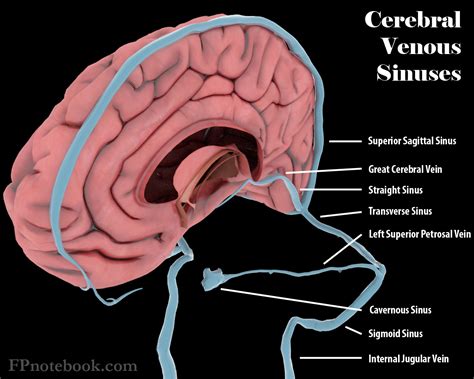 Cerebral Venous Thrombosis