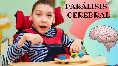 Sintomas De La Paralisis Cerebral – Otosection