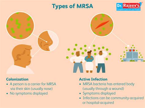 Homoeopathic treatment for Methicillin-resistant Staphylococcus aureus (MRSA)