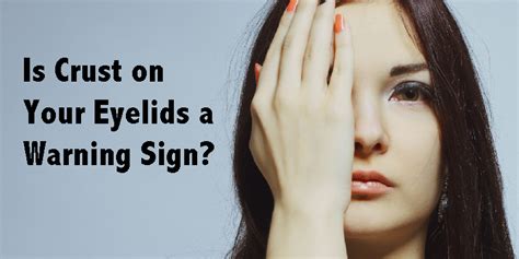 Is Crust on Your Eyelids a Warning Sign? | Warning signs, Crusty eyelids, Signs