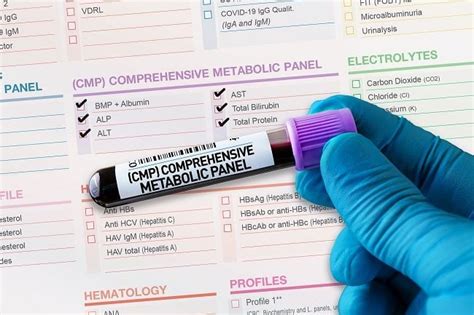 Understanding High Chloride Levels: Causes and Treatment