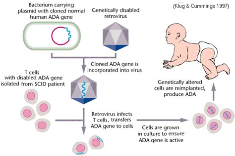 SCID ADA-deficient