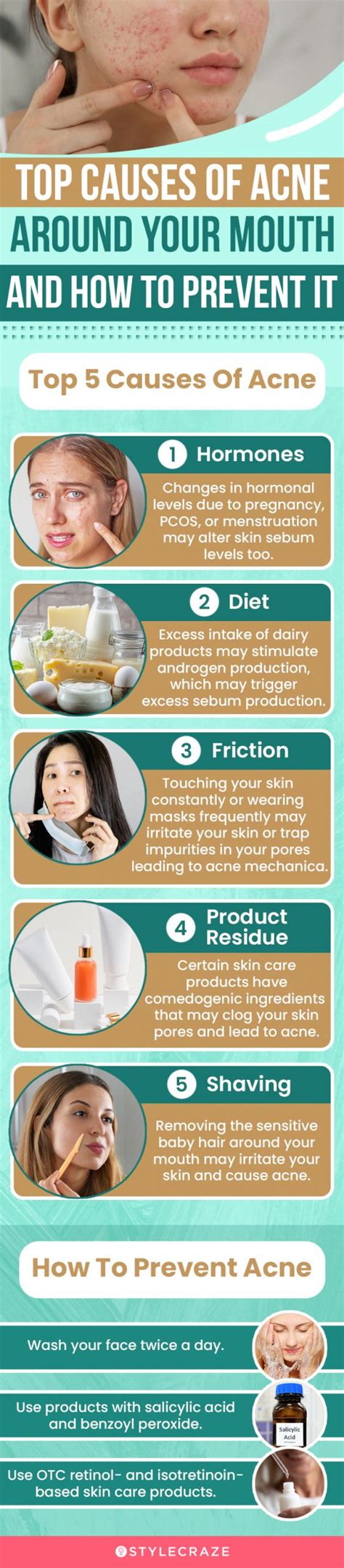 Types Of Acne Around The Mouth And How To Deal With Them