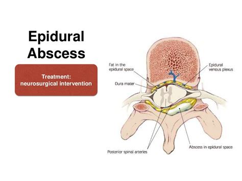 COMPLICATIONS OF SPINAL & EPIDURAL ANAESTHESIA