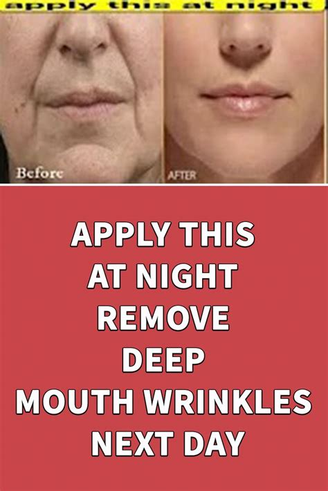 APPLY THIS AT NIGHT REMOVE DEEP MOUTH WRINKLES NEXT DAY in 2020 | Mouth ...