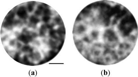 Metals | Special Issue : Amorphous Alloys