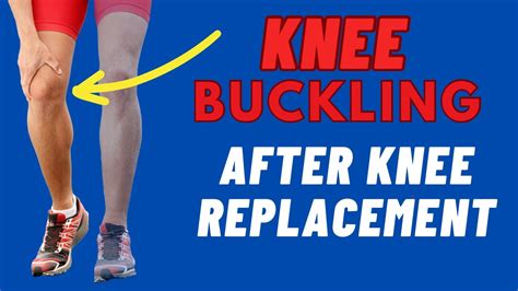 3 Exercises To Fix Knee Buckling & Why Does It Happen: Knee Replacement ...