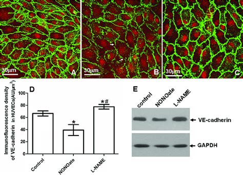 Expression of VE-cadherin in HUVECs. A-C: VE-cadherin immunostaining.... | Download Scientific ...
