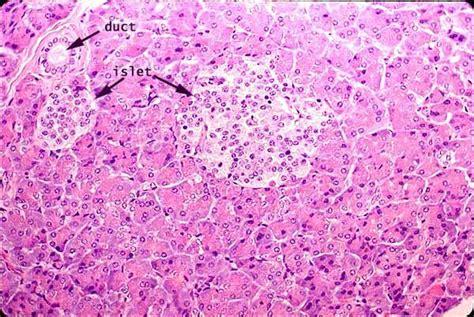 [Solved] What type of epithelium are the pancreatic Islets of ...