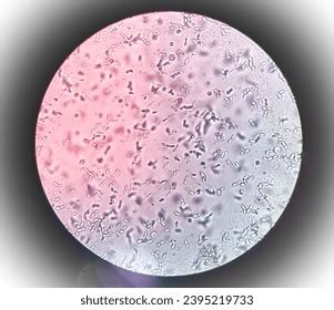 Urine Sediment Microscopic Examination Show Plenty Stock Photo ...