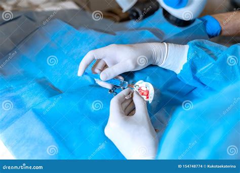 A Professional Ophthalmologist Performs Eye Surgery with a Microscope. Hands of the Surgeon ...