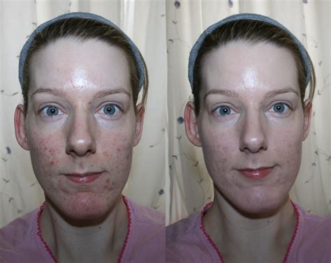 Erborian BB Creme Au Ginseng Before and After - Beauty Geek UK