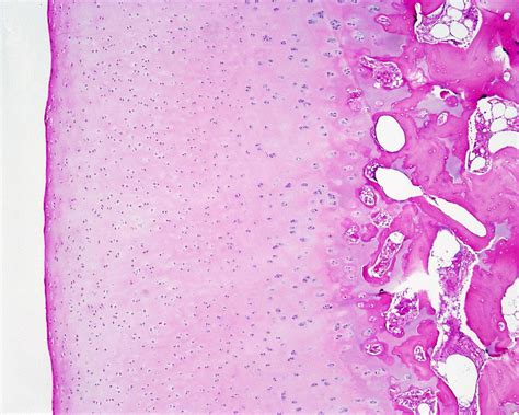 File:Cartilage histology 001.jpg - Embryology