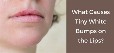 Bumps on Lips: 9 Causes, Home Remedies and Prevention Tips