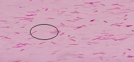 Pseudomonas Aeruginosa Gram Stain 1000X