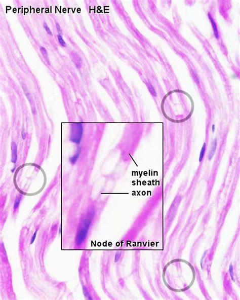 File:Peripheral nerve histology 03.jpg - Embryology