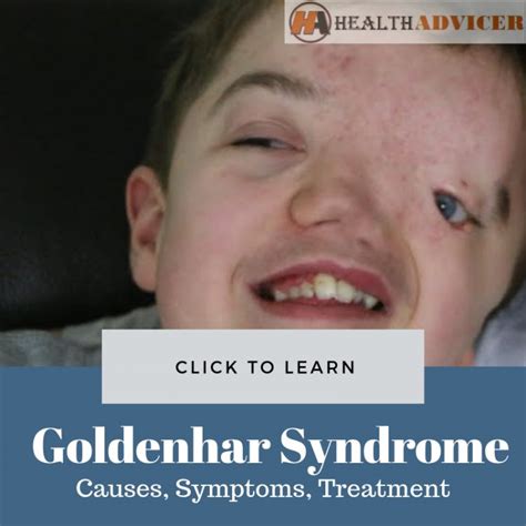 Goldenhar Syndrome Symptoms