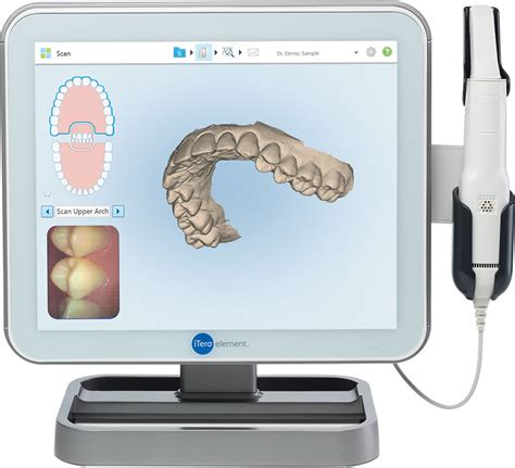 iTero Scanner - Orthodontics Limited