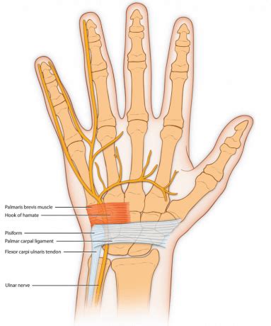 Kanaal van Guyon - Slapende vingers - Hand - Orthopedie Herentals