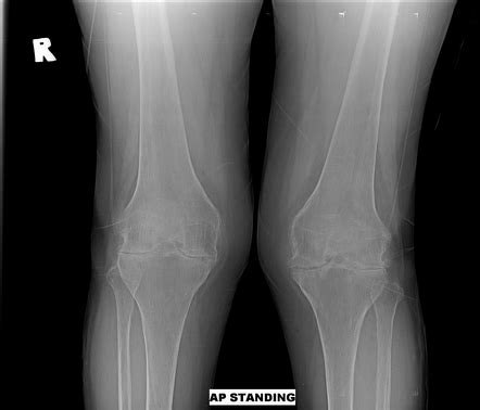 Radiology Quiz 159279 | Radiopaedia.org