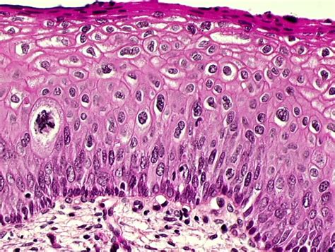 Histopathology and cytopathology of the uterine cervix - digital atlas ...