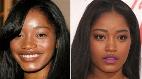 Keke Palmer’s Plastic Surgery: Details on Her Nose Job!