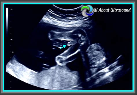 5 Best Practice Tips to OB GYN Ultrasound