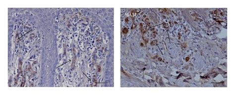 Clinical course of split-thickness skin-graft donor site wounds from... | Download Scientific ...