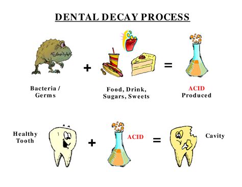 Common causes of dental cavities