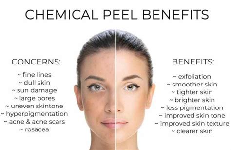 Chemical Peel Benefits