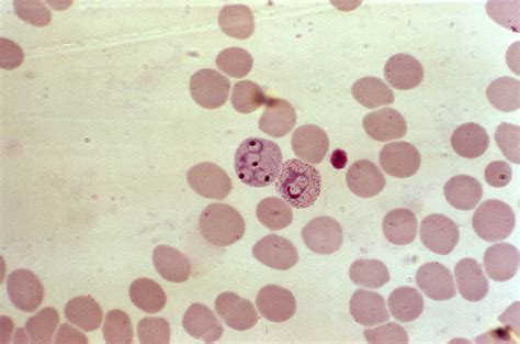 Free picture: magnified, 1000x, photomicrograph, red, blood, cell, four, plasmodium vivax, rings ...