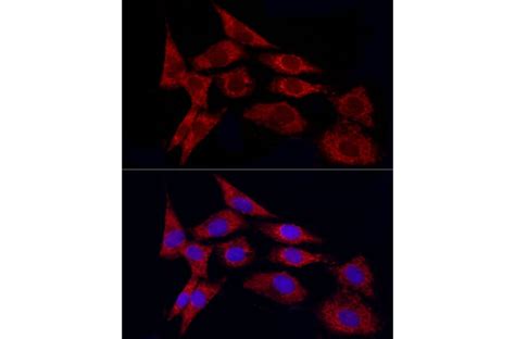 Anti-TGF beta 1 Antibody (A92358) | Antibodies.com