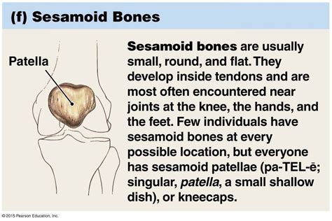 The Patella Is Classified as a Sesamoid Bone Since It: - Damari-has-Bird