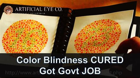 Color Blindness treatment for my brother after My Color Blindness was cured - YouTube