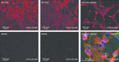 The expression of the angiogenic marker molecule CD31 in monolayer ...