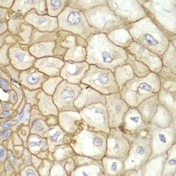 Anti HLA A Antibody | Bio-Rad