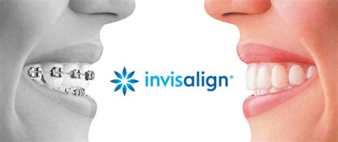 Invisalign Clear Braces Toronto | Teeth Straightening | Family Tree Dental | Family Tree Dental